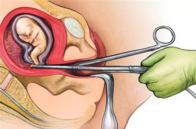 Medical Termination of Pregnancy